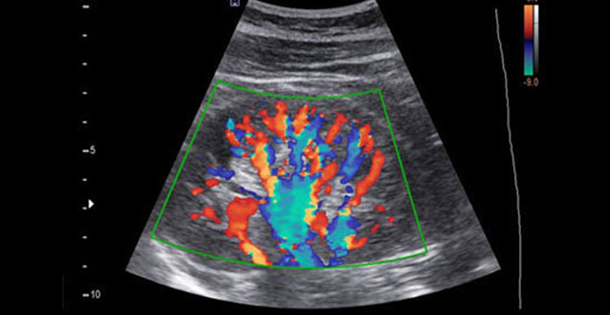 color doppler test in Pune, Hadpsar